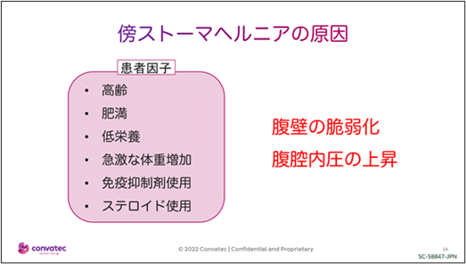 講演スライドのご紹介
